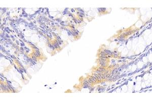 Detection of HMGCR in Rat Colon Tissue using Polyclonal Antibody to 3-Hydroxy-3-Methylglutaryl Coenzyme A Reductase (HMGCR) (HMGCR anticorps  (AA 638-887))