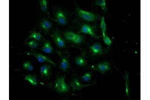 Anti-ATG3 mouse monoclonal antibody (ABIN2454895) immunofluorescent staining of COS7 cells transiently transfected by pCMV6-ENTRY ATG3 (RC203453). (ATG3 anticorps)