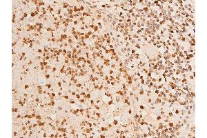 ABIN6267251 at 1/100 staining human TB tissue sections by IHC-P.