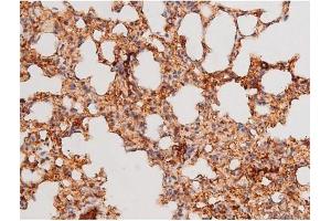 ABIN6267578 at 1/200 staining Mouse lung tissue sections by IHC-P.