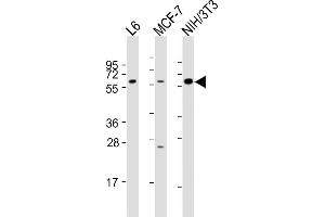 All lanes : Anti-YES1 Antibody (N-term) at 1:2000 dilution Lane 1: L6 whole cell lysates Lane 2: MCF-7 whole cell lysates Lane 3: NIH/3T3 whole cell lysates Lysates/proteins at 20 μg per lane.