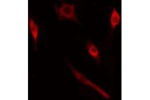 ABIN6274985 staining  HT29 cells by IF/ICC. (CRABP2 anticorps  (Internal Region))