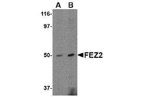 Western blot analysis of FEZ2 in mouse brain tissue lysate with AP30334PU-N FEZ2 antibody at (A) 0.