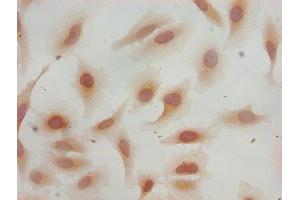 Immunocytochemistry analysis of Hela cells using ABIN7139598 at dilution of 1:100