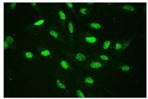 IF analysis of CTBP2 using anti-CTBP2 antibody (ABIN3042768). (CTBP2 anticorps  (AA 321-445))