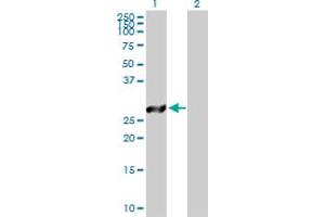 Western Blot analysis of TSSK6 expression in transfected 293T cell line by TSSK6 MaxPab polyclonal antibody. (TSSK6 anticorps  (AA 1-273))