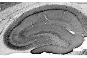 Adult rat hippocampus immunohistochemistry.