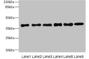 Western blot All lanes: TMEM68 antibody at 4 μg/mL Lane 1: Mouse thymus tissue Lane 2: K562 whole cell lysate Lane 3: U251 whole cell lysate Lane 4: HepG2 whole cell lysate Lane 5: MCF-7 whole cell lysate Lane 6: Jurkat whole cell lysate Secondary Goat polyclonal to rabbit IgG at 1/10000 dilution Predicted band size: 38, 30, 16 kDa Observed band size: 38 kDa (TMEM68 anticorps  (AA 74-114))