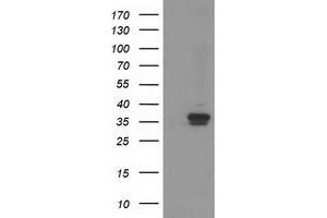 Western Blotting (WB) image for anti-Retinol Dehydrogenase 14 (All-Trans/9-Cis/11-Cis) (RDH14) antibody (ABIN1500656) (RDH14 anticorps)