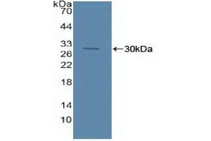 Detection of Recombinant ASM, Human using Polyclonal Antibody to Acid Sphingomyelinase (ASM) (SMPD1 anticorps  (AA 319-579))