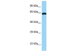 WB Suggested Anti-ABI1 Antibody Titration: 1. (ABI1 anticorps  (N-Term))