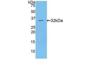 Detection of Recombinant PKCh, Human using Polyclonal Antibody to Protein Kinase C Eta (PKCh) (PKC eta anticorps  (AA 355-614))