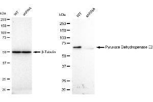 Western blotting analysis using Pyruvate Dehydrogenase E2 antibody (ABIN7798243). (Recombinant CYB561 anticorps)
