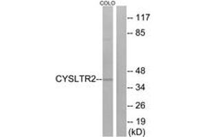 Western Blotting (WB) image for anti-Cysteinyl Leukotriene Receptor 2 (CYSLTR2) (AA 281-330) antibody (ABIN2890761) (CasLTR2 anticorps  (AA 281-330))