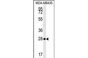 MRM1 Antibody (N-term) (ABIN654341 and ABIN2844111) western blot analysis in MDA-M cell line lysates (35 μg/lane).