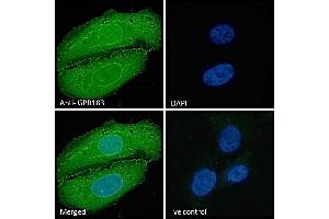 (ABIN768598) Immunofluorescence analysis of paraformaldehyde fixed U2OS cells, permeabilized with 0.