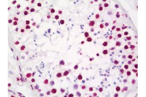 Anti-MATR3 / Matrin 3 antibody IHC staining of human testis.