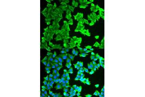 Immunofluorescence analysis of HeLa cells using RPLP0 antibody.