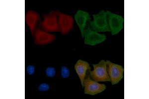 ABIN6257806 and ABIN6275277 staining Hela cells(45 min of heat-shock) by IF/ICC. (CYB5R1 anticorps  (C-Term))