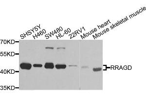 Western blot analysis of extracts of various cell lines, using RRAGD antibody. (RRAGD anticorps  (AA 181-400))