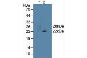 Figure. (GSTT1 anticorps  (AA 7-240))
