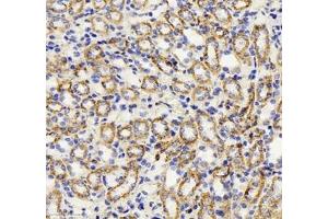 Immunohistochemistry of paraffin embedded mouse kidney using HSP60 (ABIN7074167) at dilution of 1: 1500 (300x lens)