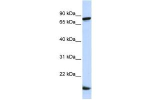 Western Blotting (WB) image for anti-Zinc Finger Protein 281 (ZNF281) antibody (ABIN2458356) (ZNF281 anticorps)