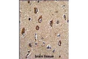 Formalin-fixed and paraffin-embedded human brain tissue with Rab5 Antibody (C-term), which was peroxidase-conjugated to the secondary antibody, followed by DAB staining.