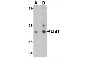 Western blot analysis of LIS1 in HeLa cell lysate AP30511PU-N at (A) 0. (PAFAH1B1 anticorps  (C-Term))