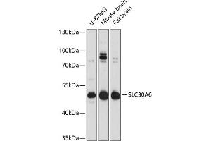 Western blot analysis of extracts of various cell lines, using SLC30 Antibody  at 1:3000 dilution. (SLC30A6 anticorps  (AA 252-461))