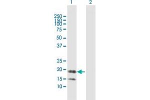 Lane 1: IL1RN transfected lysate ( 20.