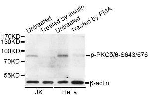 Western blot analysis of extracts of HeLa and 293 cells, using Phospho-PKCδ/θ-S643/676 antibody (ABIN5996816) at 1/1000 dilution. (PKC delta/theta (pSer643), (pSer676) anticorps)