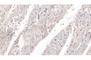 Detection of WNT4 in Human Cardiac Muscle Tissue using Monoclonal Antibody to Wingless Type MMTV Integration Site Family, Member 4 (WNT4)