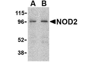 Image no. 1 for anti-Phorbol-12-Myristate-13-Acetate-Induced Protein 1 (PMAIP1) (N-Term) antibody (ABIN318707) (NOXA anticorps  (N-Term))
