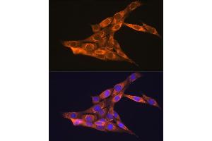 Immunofluorescence analysis of NIH-3T3 cells using VEGFB Rabbit pAb (ABIN3022999, ABIN3023000, ABIN3023001 and ABIN6219338) at dilution of 1:100 (40x lens).