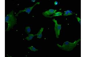 Immunofluorescence staining of U251 cells with ABIN7140118 at 1:50, counter-stained with DAPI. (RHBDD3 anticorps  (AA 304-323))