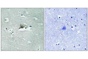 Immunohistochemical analysis of paraffin-embedded human brain tissue using Claudin 5 (Phospho-Tyr217) antibody (left)or the same antibody preincubated with blocking peptide (right). (Claudin 5 anticorps  (pTyr217))