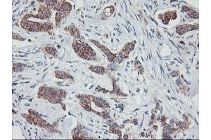 Image no. 5 for anti-Golgi Membrane Protein 1 (GOLM1) antibody (ABIN1498496)