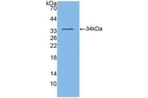 Detection of Recombinant ITGb3, Human using Polyclonal Antibody to Integrin Beta 3 (ITGb3) (Integrin beta 3 anticorps  (AA 135-377))