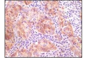 Immunohistochemistry (IHC) image for anti-Synuclein, gamma (Breast Cancer-Specific Protein 1) (SNCG) (truncated) antibody (ABIN2464104) (SNCG anticorps  (truncated))