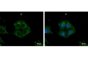 ICC/IF Image TRIM32 antibody detects TRIM32 protein at cytoplasm by immunofluorescent analysis.