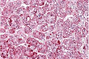 ABIN571194 (5µg/ml) staining of paraffin embedded Human Adrenal Gland. (ETFA anticorps  (AA 139-152))