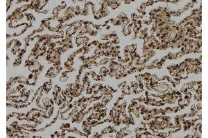 ABIN6272990 at 1/100 staining Human lung tissue by IHC-P. (AGTPBP1 anticorps  (Internal Region))