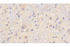 Detection of F5 in Mouse Cerebellum Tissue using Polyclonal Antibody to Coagulation Factor V (F5) (Coagulation Factor V anticorps  (AA 1863-2161))