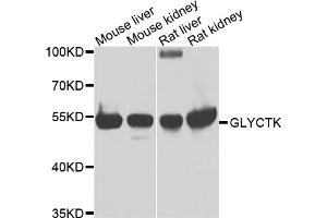 Western blot analysis of extracts of various cell lines, using GLYCTK antibody. (GLYCTK anticorps)