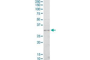 CDK4 monoclonal antibody (M03), clone 4F11.