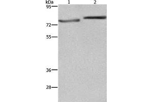 Western Blot analysis of PC3 and Hela cell using COMP Polyclonal Antibody at dilution of 1:600