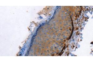 Immunohistochemistry of paraffin-embedded Human skin using Caldesmon Polyclonal Antibody at dilution of 1:40