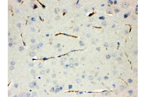Calcitonin was detected in paraffin-embedded sections of mouse lung tissues using rabbit anti- Calcitonin Antigen Affinity purified polyclonal antibody (Catalog # ) at 1 µg/mL. (CGRP anticorps  (C-Term))