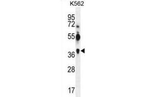 Western Blotting (WB) image for anti-Melanoma Antigen Family A, 12 (MAGEA12) antibody (ABIN3002530) (MAGEA12 anticorps)